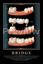 Load image into Gallery viewer, Bridge Wall Chart