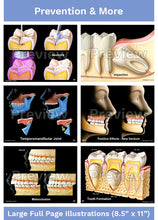 Load image into Gallery viewer, Hygienist-Patient Consultation Illustrations